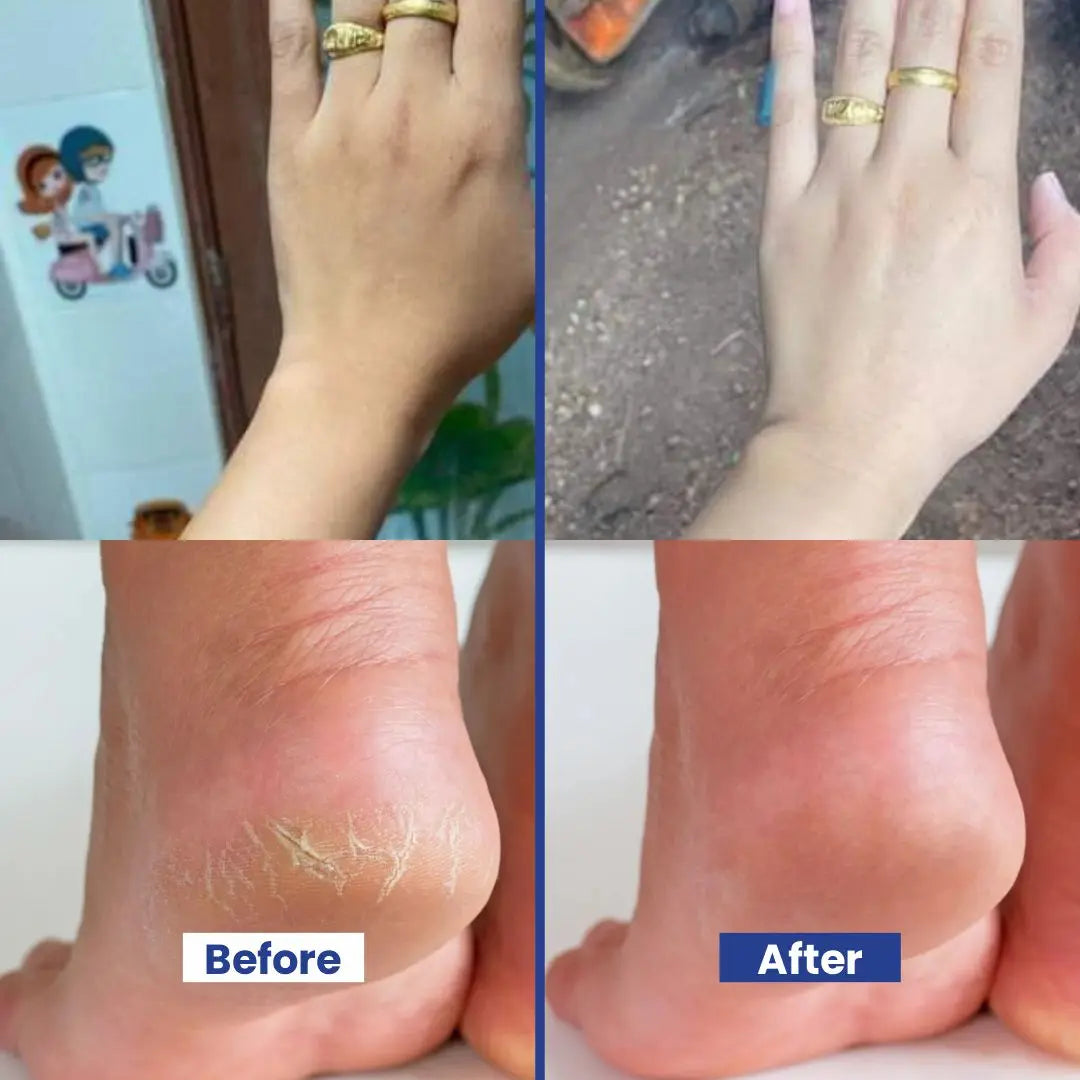 Hand & Feet Scrub with Vitamin E, Olive Oil & Jojoba Oil – Deep Hydration, Exfoliation, Cracked Heels Repair & Smooth Skin Treatment – 50g