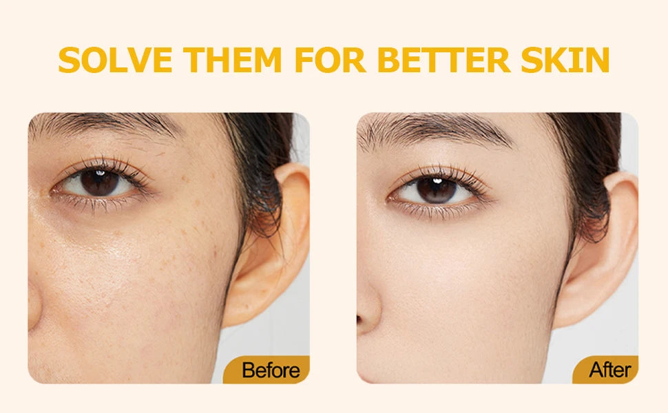 Deep Vitamin C Golden Capsule Face Moisturizer – Hydrating & Whitening Cream