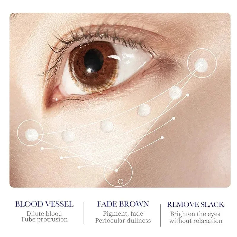 SADOER Collagen Eye Cream – Anti Dark Circles, Puffiness & Firming Moisturizing Eye Treatment (20g)