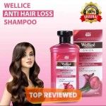 Original Wellice Onion Anti Hair Loss Shampoo 400ml – Hair Growth & Damage Repair with Natural Onion Extracts