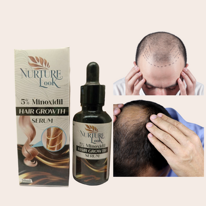 Hair Growth Serum with 5% Minoxidil & Biotin – Stops Hair Fall, Activates Sleeping Roots, Promotes Thick & Long Hair
