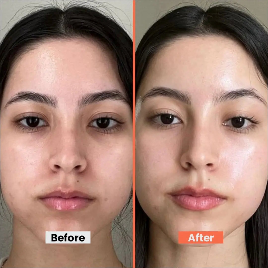 Sun Protection & Moisture Cream SPF 50 – Non-Comedogenic Sunscreen for Sensitive Skin with Aloe Vera, Papaya, Vitamin E & Saffron – 50gm