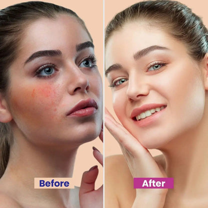 Max Hydration Goldish Beauty Cream 26gm – Anti-Aging, Brightening, Hydrating Formula with Vitamin B6, Arbutin & Zinc Oxide for Dark Spots & Sun Damage