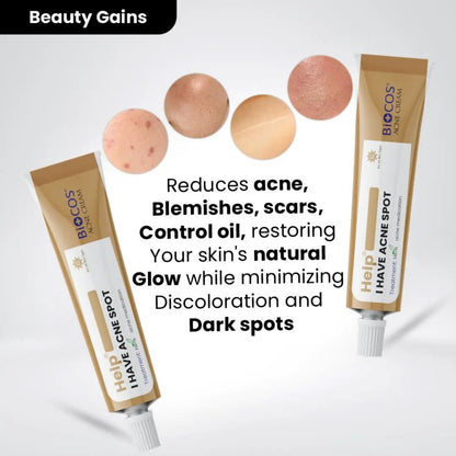 Anti Acne Cream for Pimples, Scars & Blemishes – Aloe Vera, Neem, Zinc Oxide – 12gm