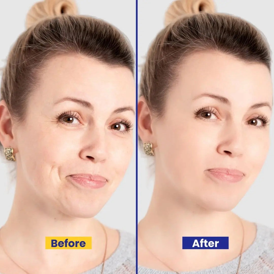 5-in-1 Beauty Cream – Anti-Aging, Brightening & Deep Hydrating Formula with Arbutin, Vitamin E, B5, Kojic Acid, Glutathione & Licorice Extract – 26gm