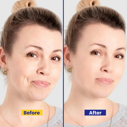 5-in-1 Beauty Cream – Anti-Aging, Brightening & Deep Hydrating Formula with Arbutin, Vitamin E, B5, Kojic Acid, Glutathione & Licorice Extract – 26gm