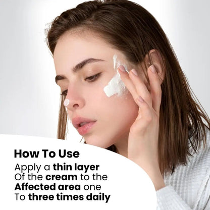 Anti Acne Cream for Pimples, Scars & Blemishes – Aloe Vera, Neem, Zinc Oxide – 12gm