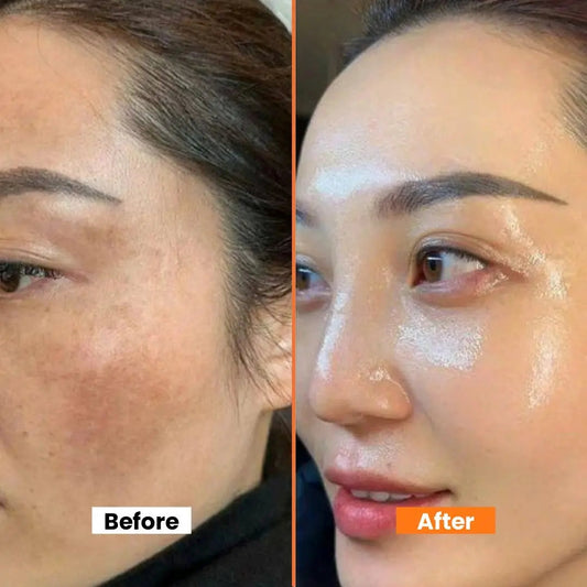 Dark Spot Correcting Cream 40gm – Brightening & Hydrating with Sweet Almond Oil, Glycerin & Antioxidants | Fades Dark Spots, Pigmentation & Uneven Skin Tone