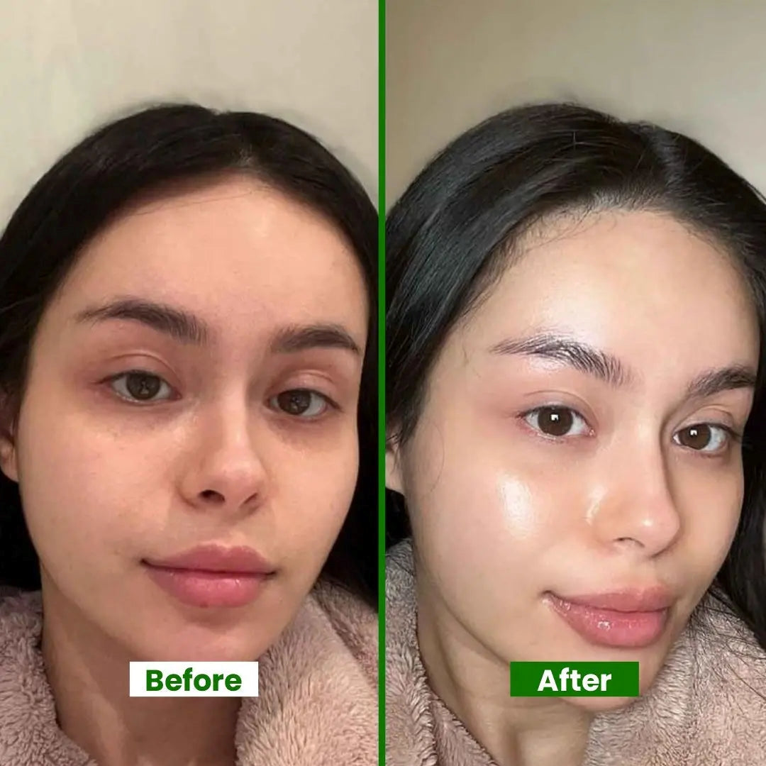 Aloe Vera Face Wash Mousse – Refreshing Foaming Cleanser with Vitamin E & Pro-Vitamin B5 | Deep Pore Cleansing, Hydrating, Anti-Breakout Formula – 120ml – Beauty Gains