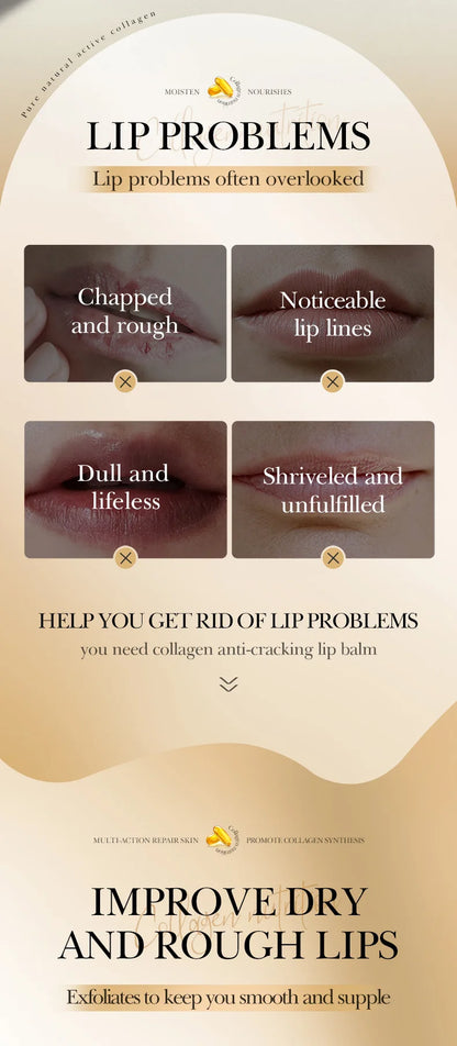 SADOER Collagen Lip Balm – Moisturizing, Nourishing & Repairing Lip Care