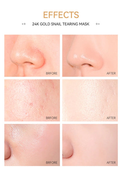 LAIKOU 24K Gold Sakura Peeling Face Mask – Anti-Wrinkle, Whitening & Blackhead Removal (50g)