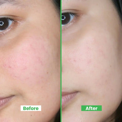 Water Facial Mist - 120ml – Cucumber, Tea Tree, Rose, Aloe Vera & Neem