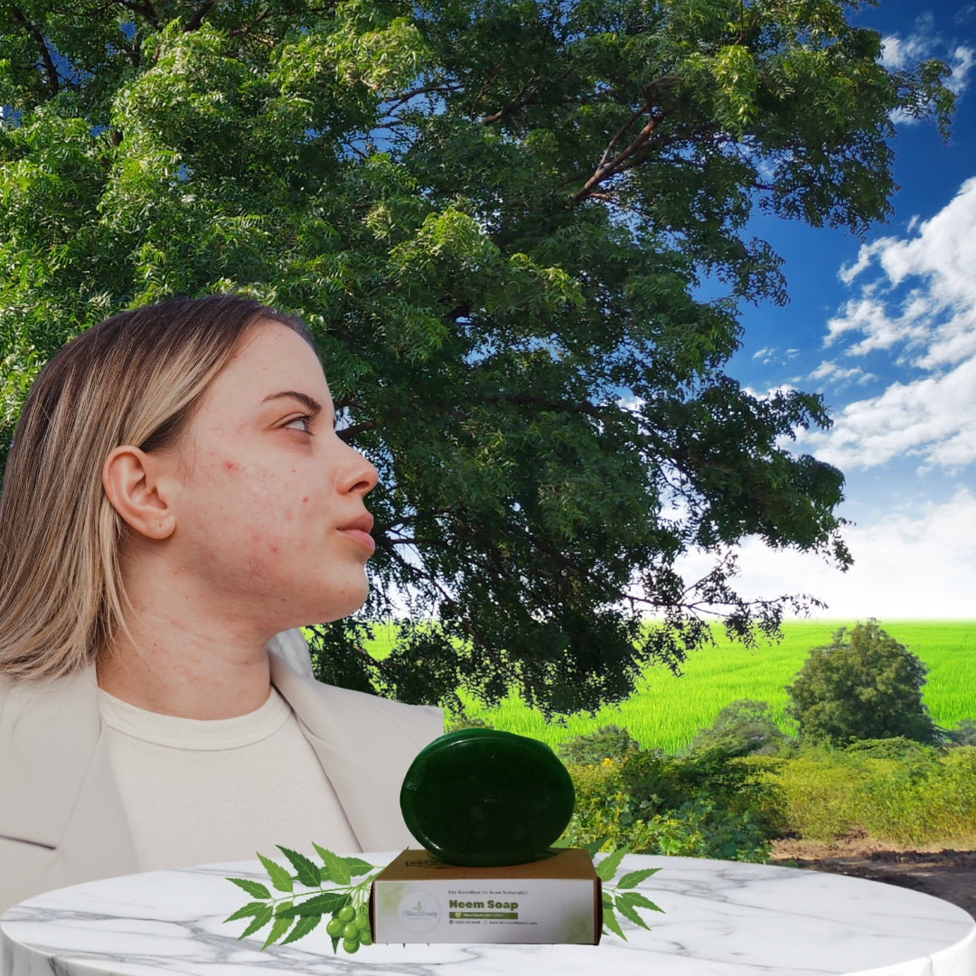 Neem & Tea Tree Anti-Acne Soap with Moringa & Vitamin E – Purifying & Skin-Calming Formula – 100g